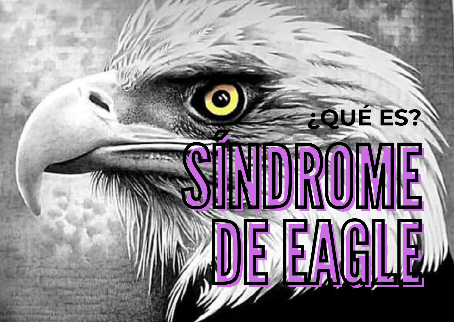 sindrome de eagle fisioterapia ciudad lineal